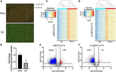 Alteration of m6A epitranscriptomic tagging of ribonucleic acids after spinal cord injury in mice